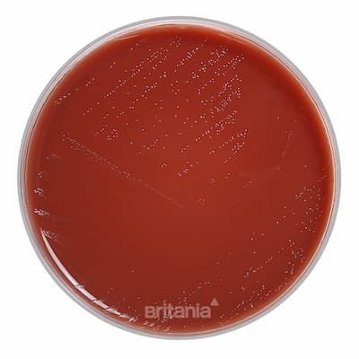 Thayer Martin Medio Modificado