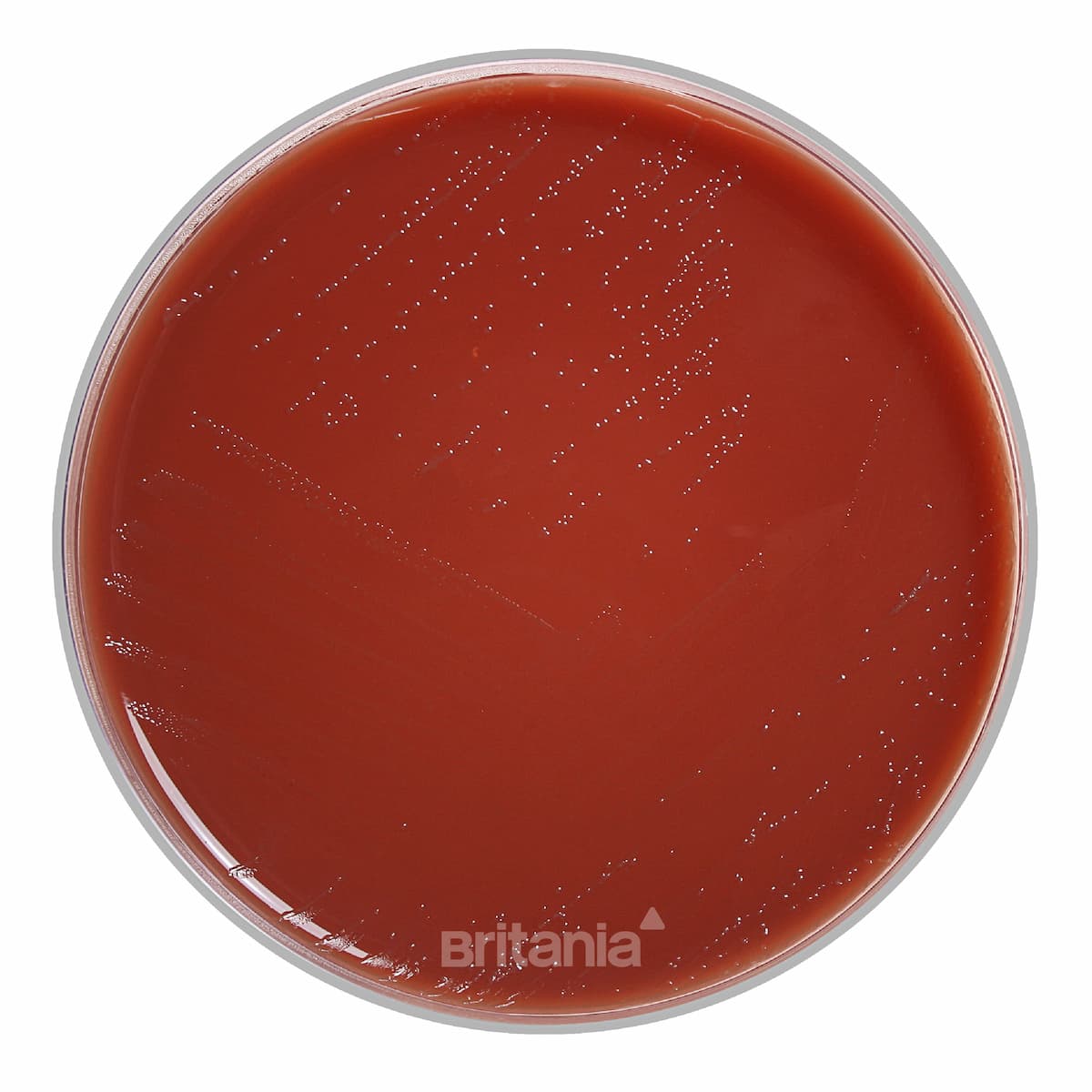 Thayer Martin Medio Modificado